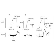 Micro Nitric Oxide Sensors