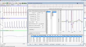 ECG Analysis Module