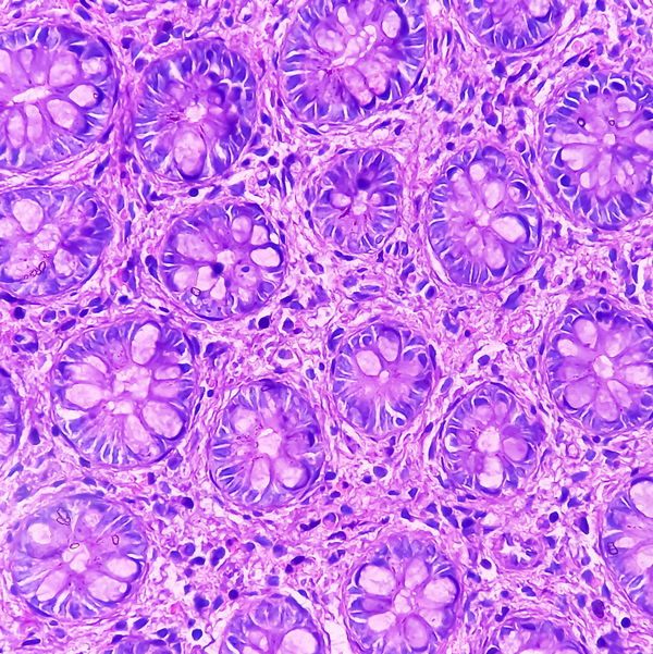 Fibronectin Coated Culture Dishes