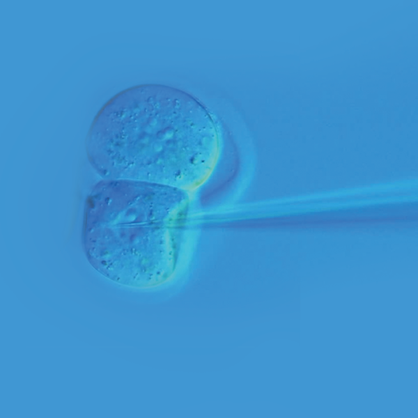 Electroporation vs Zebrafish Embryonic Transfection