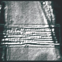 Data Acquisition Designed for Muscle Physiology Pre-Clinical Trials