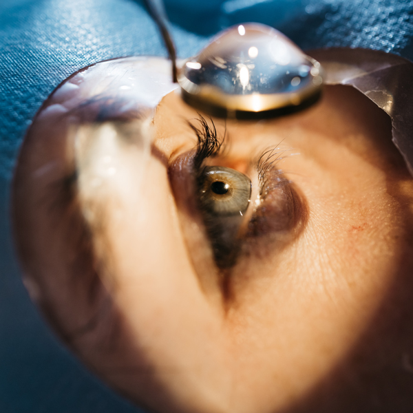 TEER in Ophthalmology for Advanced Research with RPE Cells