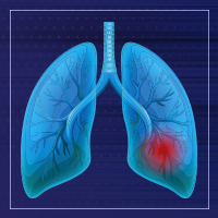 lung epithelial cells