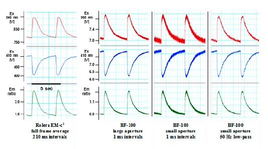 Ca2 detect heart